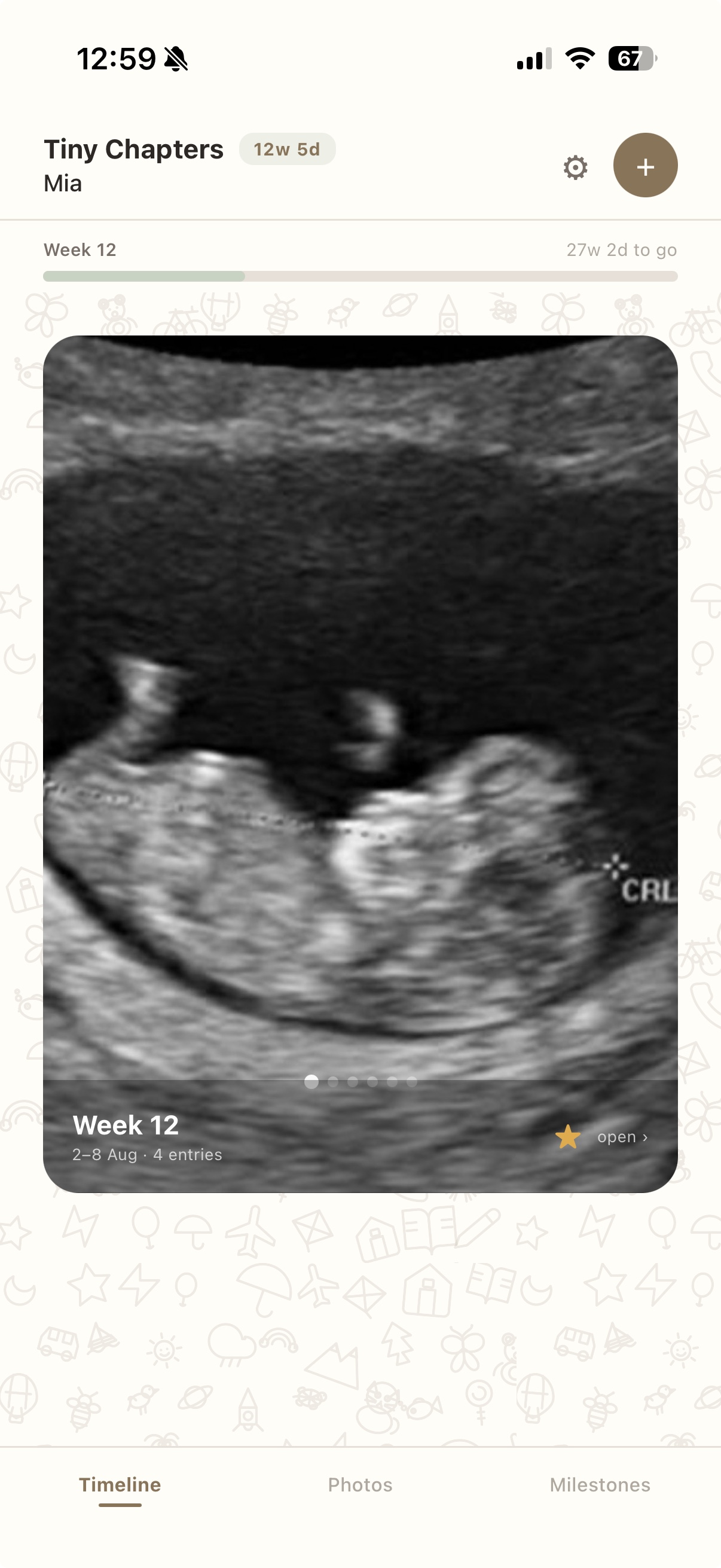 Week 12 timeline with ultrasound photo